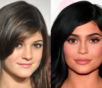 le star, prima e dopo…